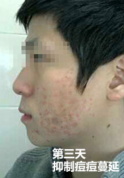 ���ݷ���Ƥ����ҽԺ