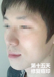 ���ݷ���Ƥ����ҽԺ