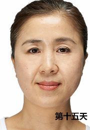 ���ݷ���Ƥ����ҽԺ