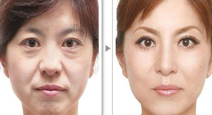 广州肤康皮肤病医院