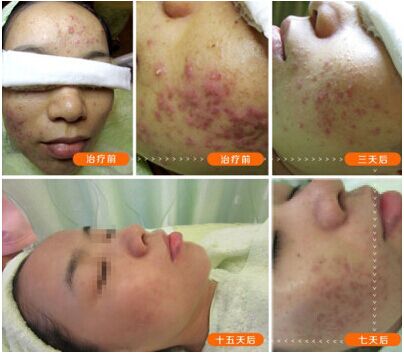 广州肤康皮肤病医院