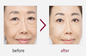 广州肤康皮肤病医院