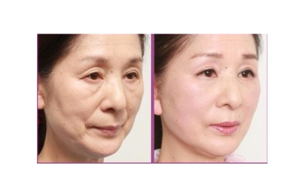 ���ݷ���Ƥ����ҽԺ