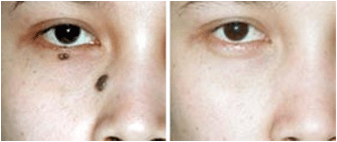 ���ݷ���Ƥ����ҽԺ