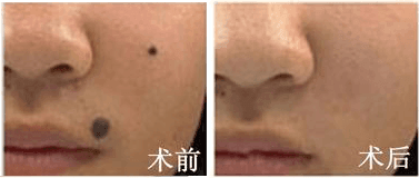 ���ݷ���Ƥ����ҽԺ