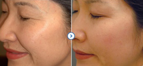 广州肤康皮肤病医院